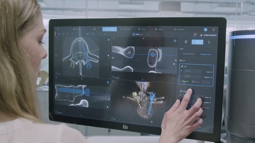 IMQ apuesta por la innovación como socio de Cyber Surgery y su robot quirúrgico de columna